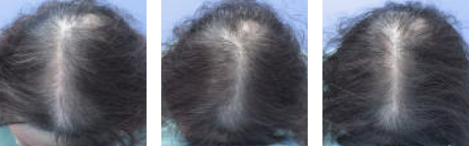 初診時4ヵ月後11ヵ月後