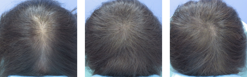 初診時4ヵ月後10ヵ月後