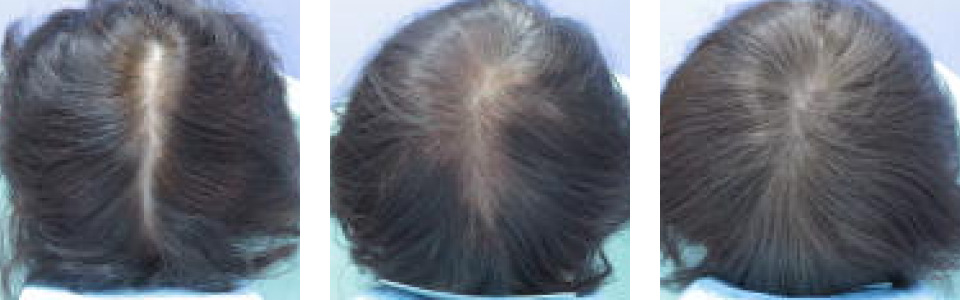 初診時4ヵ月後6ヵ月後