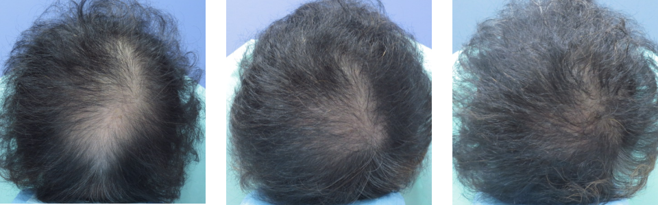 初診時6ヵ月後13ヵ月後