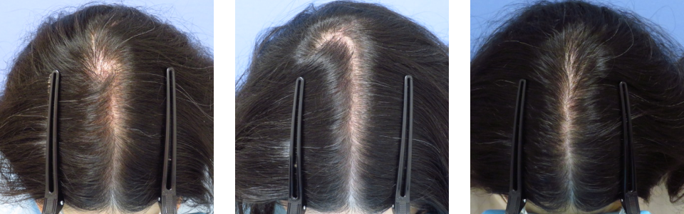 初診時3ヵ月後11ヵ月後