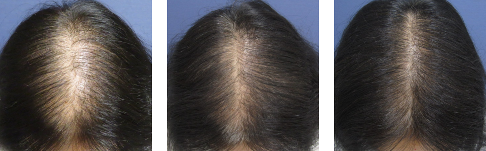 初診時3ヵ月後6ヵ月後