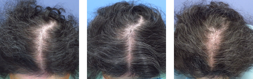 初診時7ヵ月後12ヵ月後