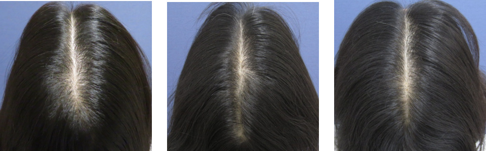 初診時3ヵ月後6ヵ月後