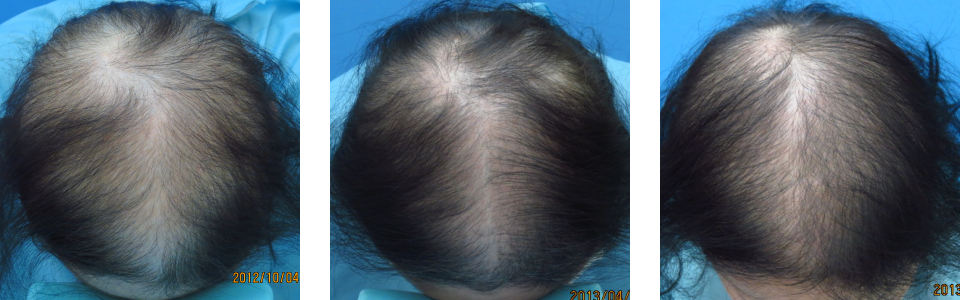 初診時6ヵ月後12ヵ月後