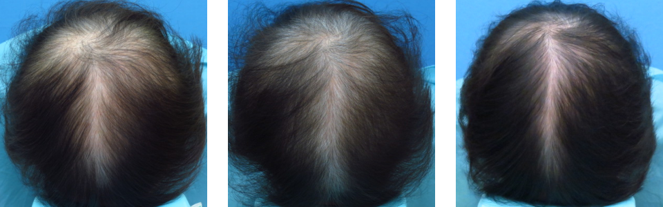 初診時5ヵ月後12ヵ月後