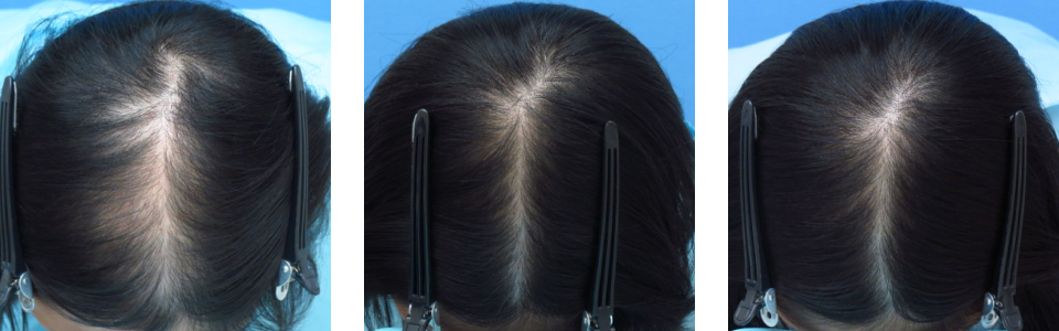 初診時6ヵ月後12ヵ月後