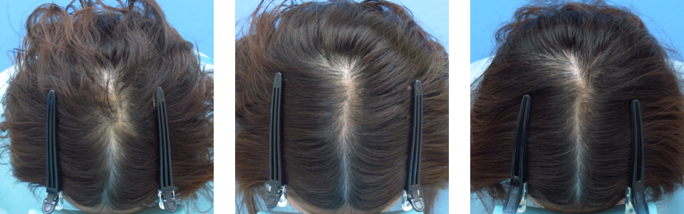 初診時6ヵ月後12ヵ月後