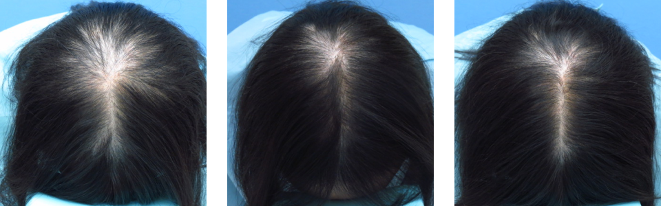 初診時4ヵ月後10ヵ月後