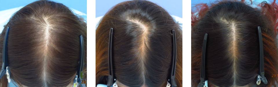 初診時7ヵ月後14ヵ月後