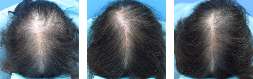 初診時6ヵ月後12ヵ月後