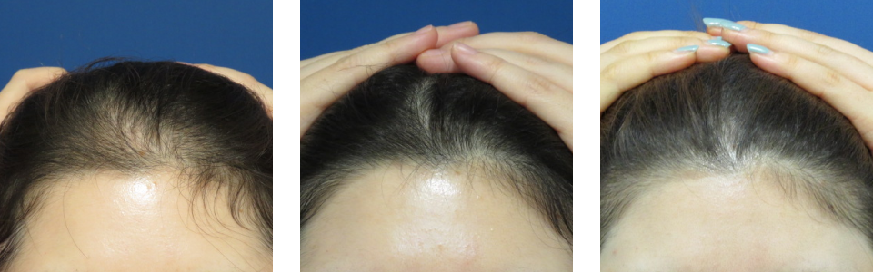 初診時4ヵ月後12ヵ月後