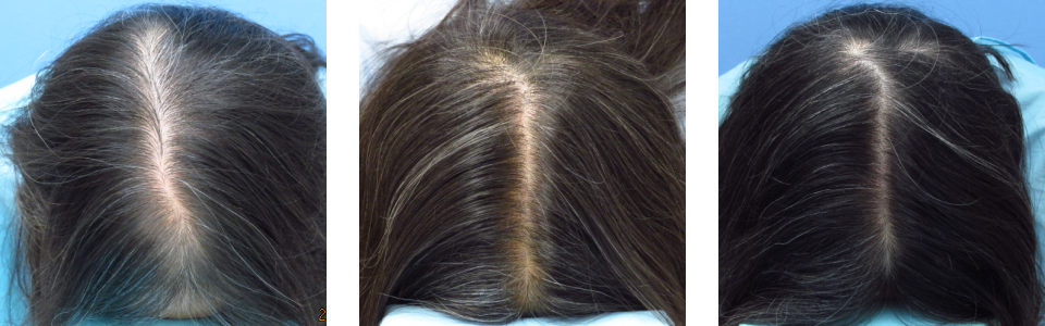 初診時4ヵ月後20ヵ月後