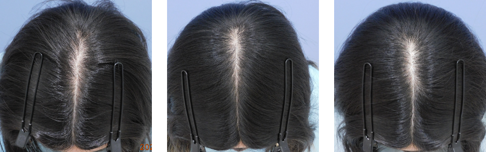 初診時6ヵ月後12ヵ月後