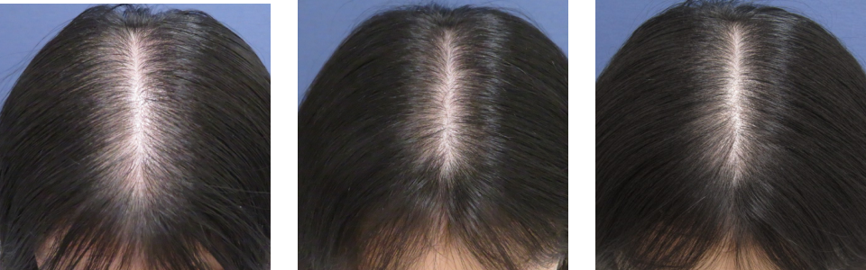 初診時3ヵ月後7ヵ月後