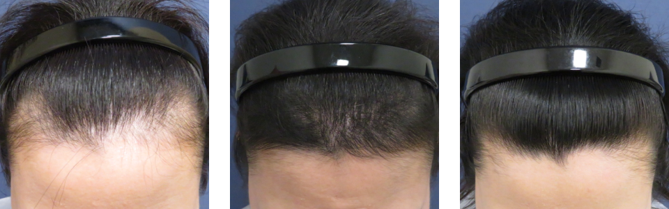 初診時3ヵ月後6ヵ月後