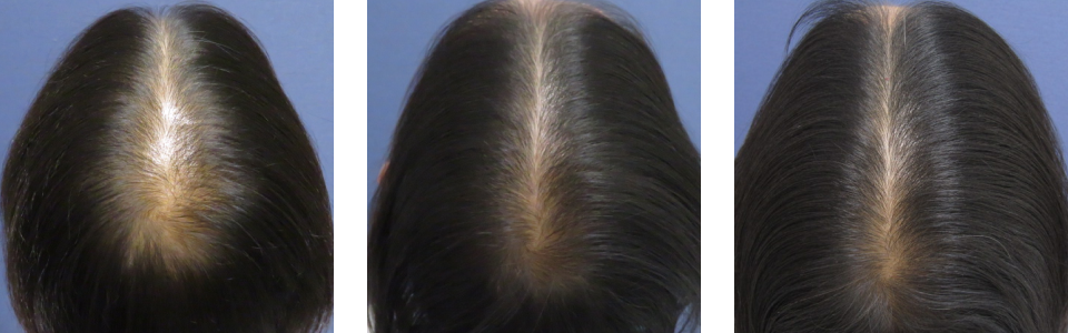 初診時3ヵ月後6ヵ月後