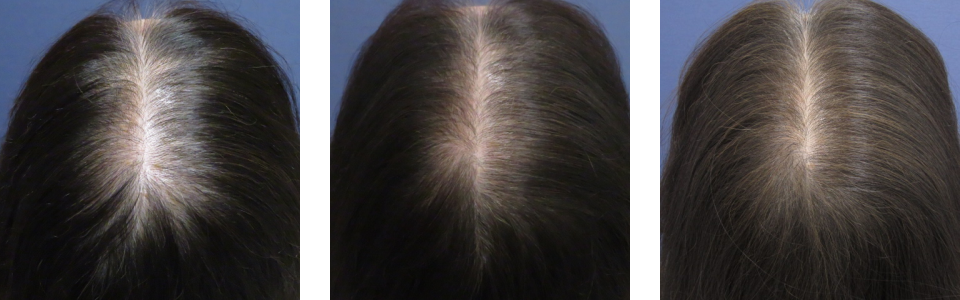 初診時3ヵ月後6ヵ月後