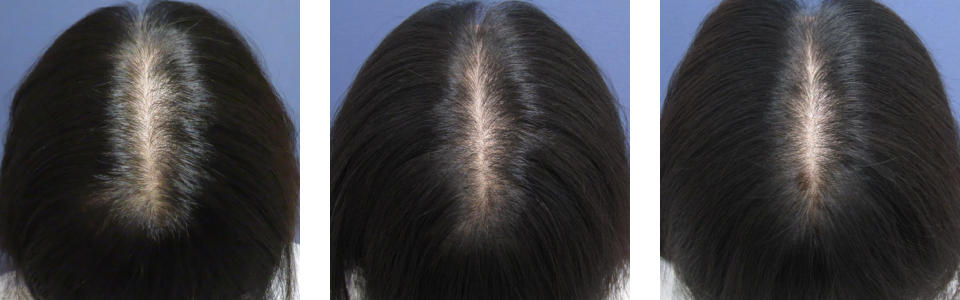 初診時3ヵ月後6ヵ月後