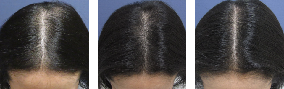 初診時3ヵ月後6ヵ月後