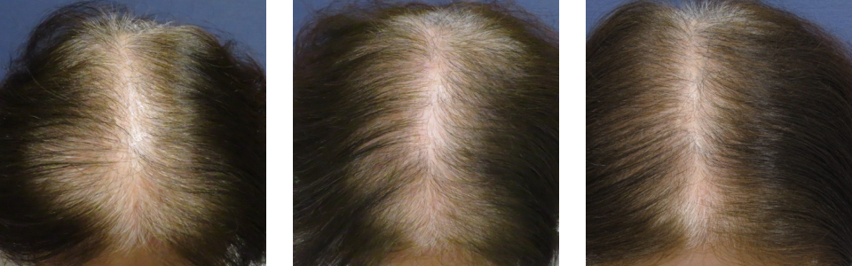 初診時3ヵ月後6ヵ月後