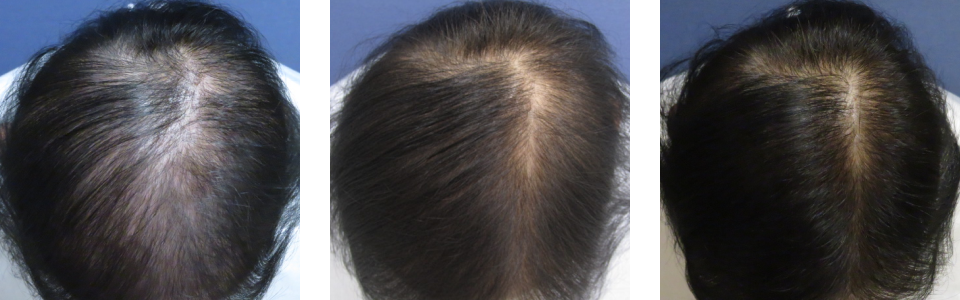 初診時6ヵ月後11ヵ月後