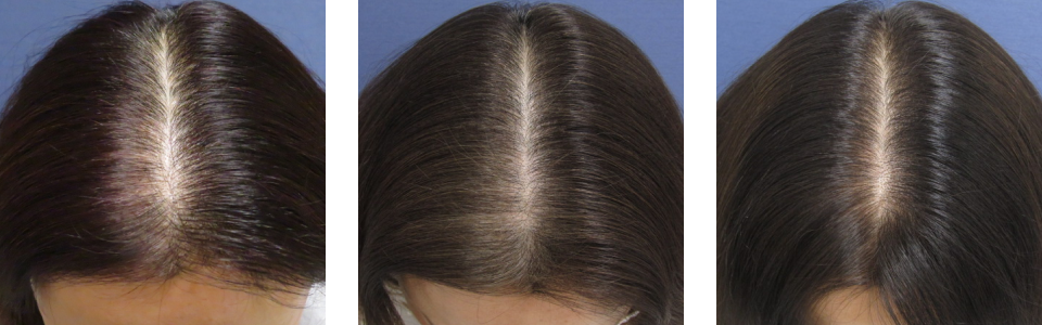 初診時3ヵ月後6ヵ月後