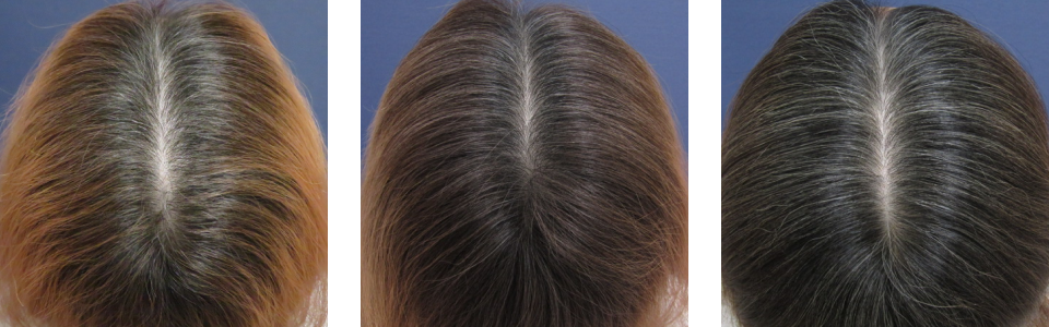 初診時3ヵ月後6ヵ月後