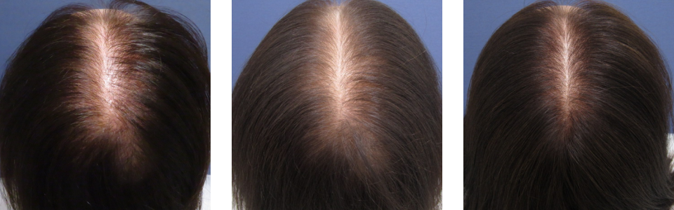 初診時3ヵ月後6ヵ月後