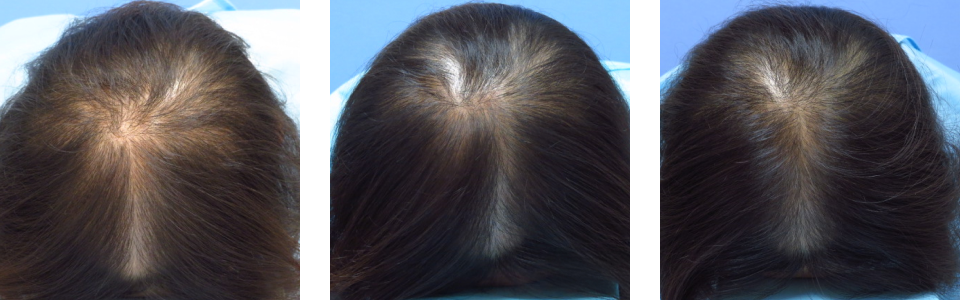 初診時3ヵ月後17ヵ月後