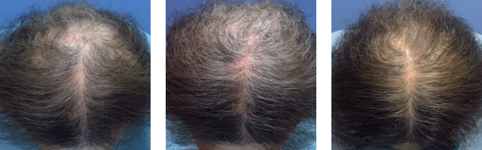 初診時6ヵ月後12ヵ月後