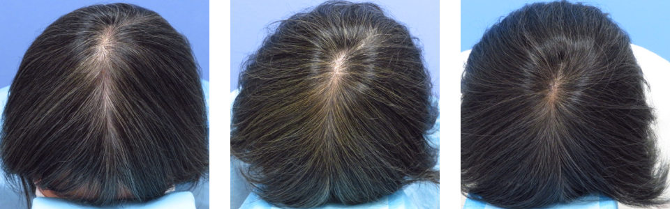 初診時6ヵ月後18ヵ月後