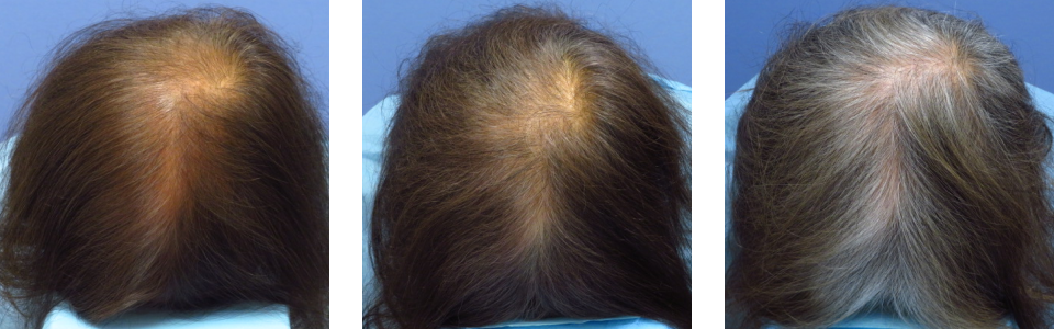 初診時6ヵ月後10ヵ月後