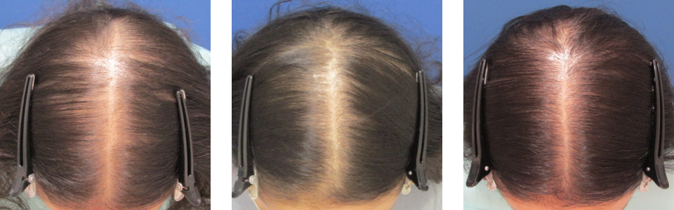 初診時4ヵ月後6ヵ月後