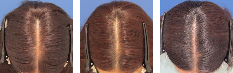 初診時6ヵ月後24ヵ月後