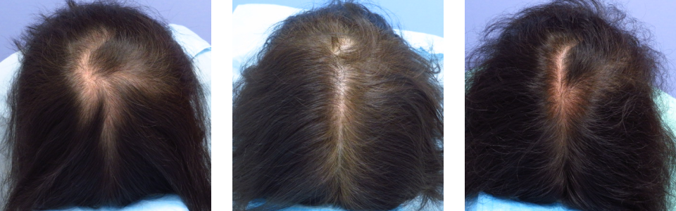 初診時6ヵ月後13ヵ月後