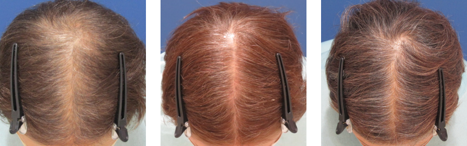 初診時4ヵ月後6ヵ月後