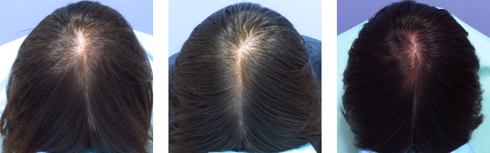 初診時7ヵ月後15ヵ月後