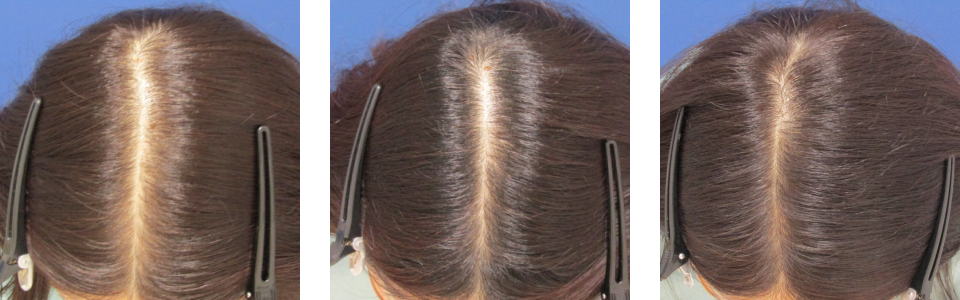 初診時4ヵ月後6ヵ月後