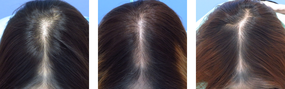 初診時8ヵ月後15ヵ月後