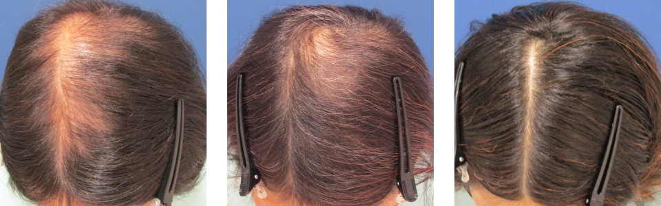 初診時4ヵ月後12ヵ月後