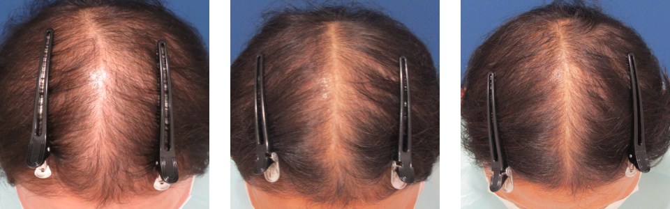 初診時6ヵ月後12ヵ月後