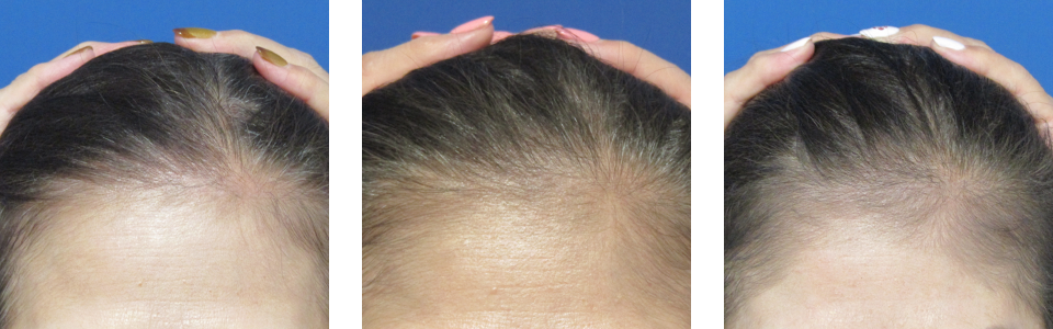 初診時4ヵ月後12ヵ月後