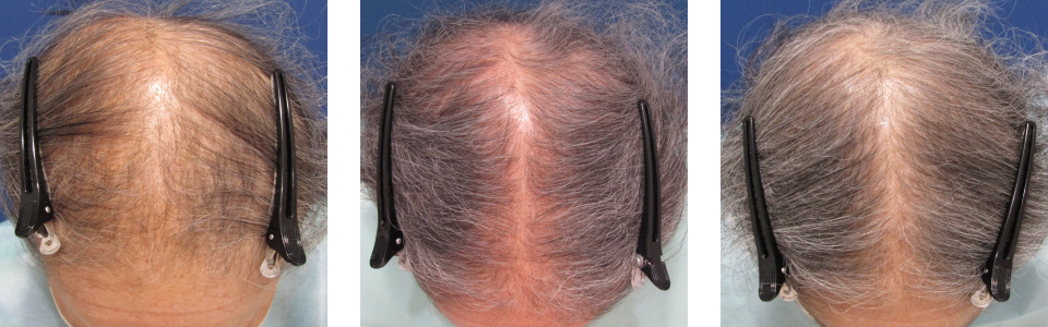 初診時6ヵ月後12ヵ月後