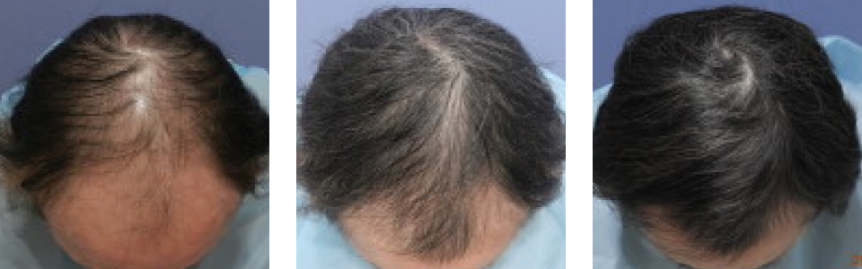 初診時5ヵ月後12ヵ月後