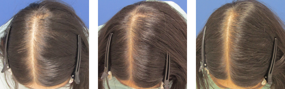 初診時4ヵ月後8ヵ月後