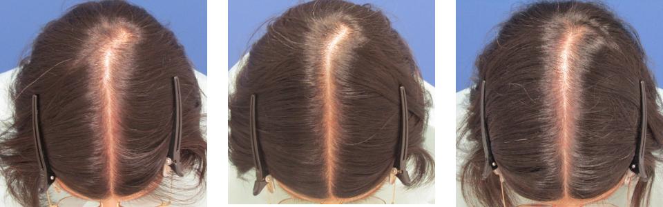 初診時4ヵ月後6ヵ月後