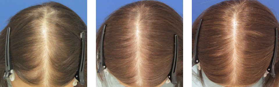 初診時4ヵ月後6ヵ月後