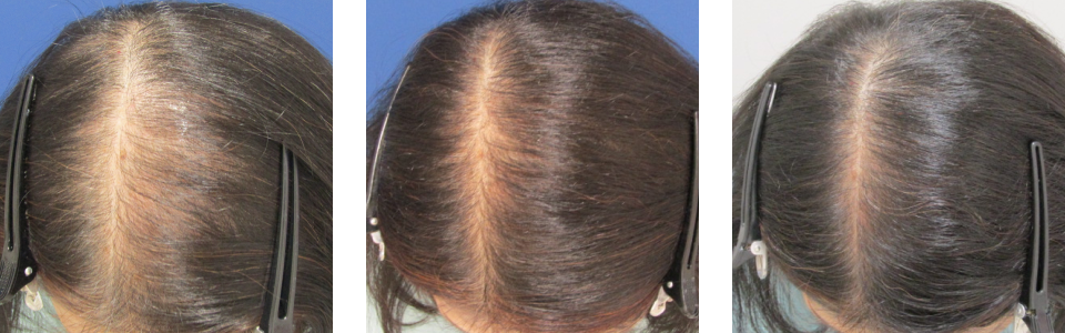 初診時6ヵ月後8ヵ月後