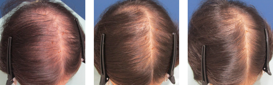 初診時4ヵ月後8ヵ月後